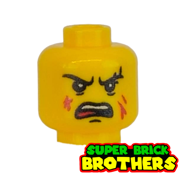 Anger